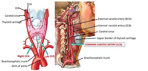 Common Carotid Artery , Carotid sinus and carotid body , Anatomy QA