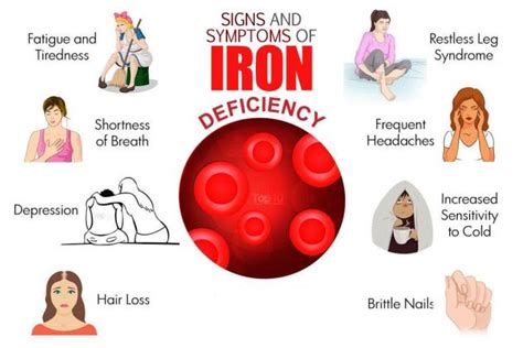 Iron deficiency anemia