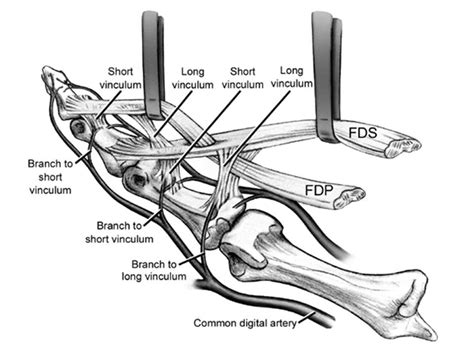 Flexor Tendon Injuries - Lessons - Blendspace