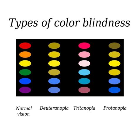 Understanding the Spectrum of Color Blindness - Facty Health