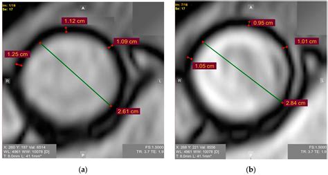 J. Imaging | Free Full-Text | Existing and Emerging Approaches to Risk ...