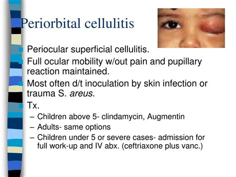 PPT - Ocular emergencies PowerPoint Presentation - ID:764166