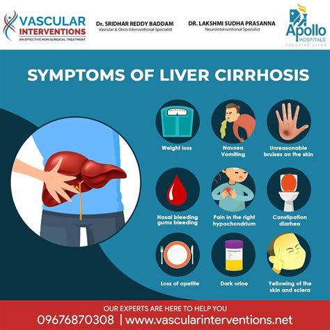 Liver Cirrhosis Symptoms Causes And Prevention | Images and Photos finder