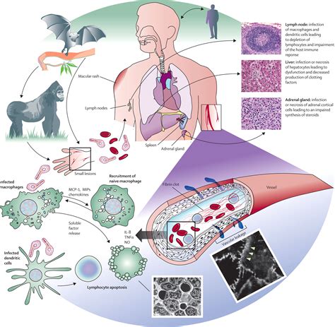 Cardiovascular and Pulmonary Impact of the Ebola Virus: A Review of ...