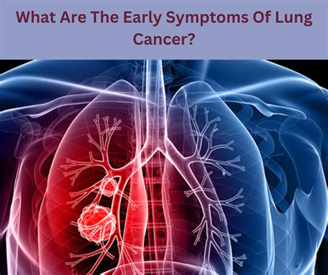 What Are The Early Symptoms Of Lung Cancer?