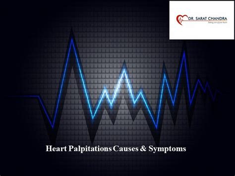 Heart Palpitations Causes and Symptoms | Dr. Sarat