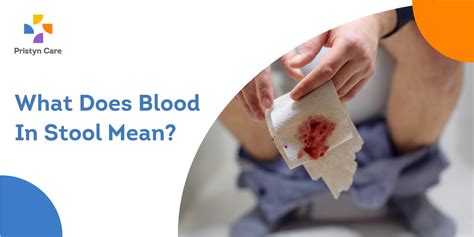 What Does Blood In Stool Mean? - Pristyn Care