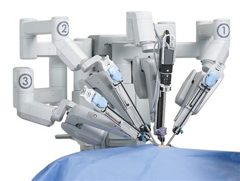 The Robot Assisted Surgery for Epilepsy that Changed on Man’s Life ...