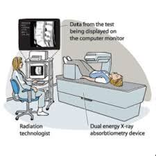 DEXA (DXA) Scan: Bone Mineral Density Test Purpose, procedure