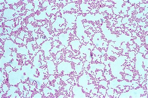 1. Pseudomonas fluorescens | Microbiology, Microbiology lab, Medical ...