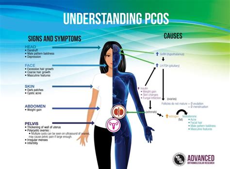 Polycystic Ovarian Syndrome | Symptoms And Causes | Funender.Com