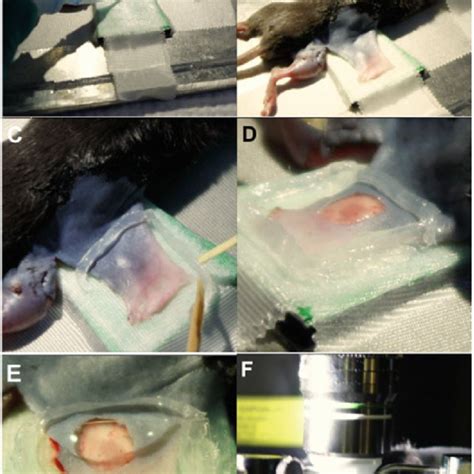 Sequential steps of the surgical procedure to expose the lymph node for ...