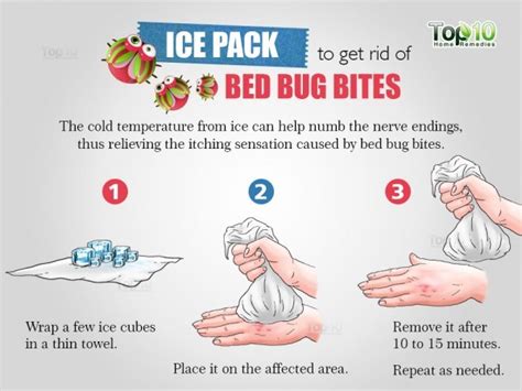 How to Get Rid of Bed Bug Bites | Top 10 Home Remedies