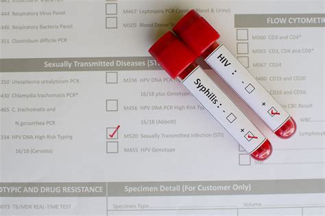 STD – TestSource Lab