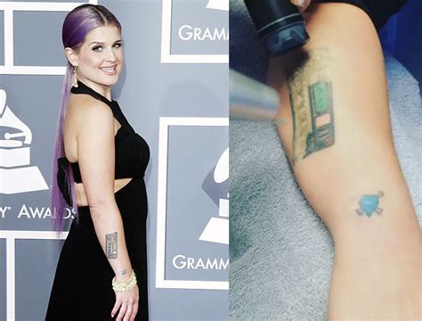 Celebrities That Removed Their Tattoo Mistakes