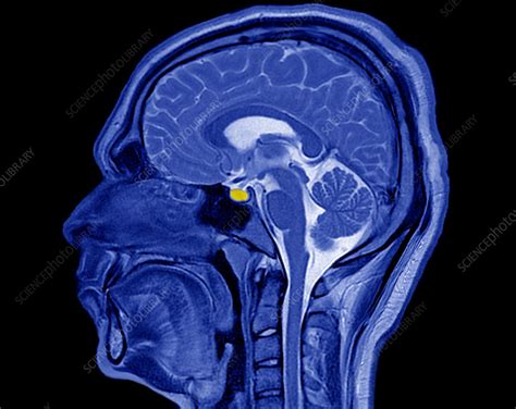 Head, brain and pituitary gland, MRI scan - Stock Image - C037/3115 ...