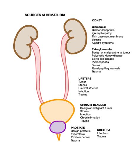 Hematuria Causes, Symptoms | Homeopathic Treatment