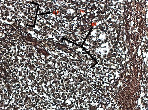 Reticular Connective Tissue 20x | Histology