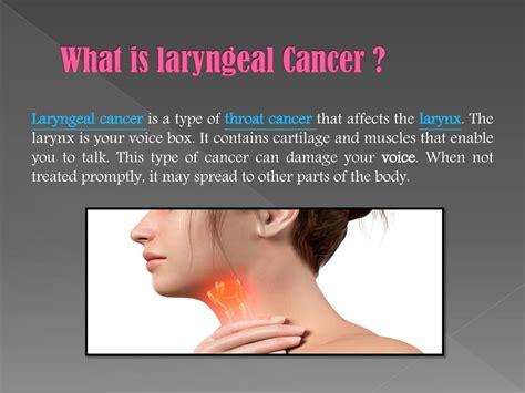 PPT - Laryngeal Cancer: Symptoms, causes, diagnosis and treatment ...