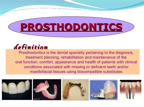 Introduction to fixed partial denture