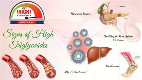 3 Common Signs Of High Triglycerides And Cholesterol