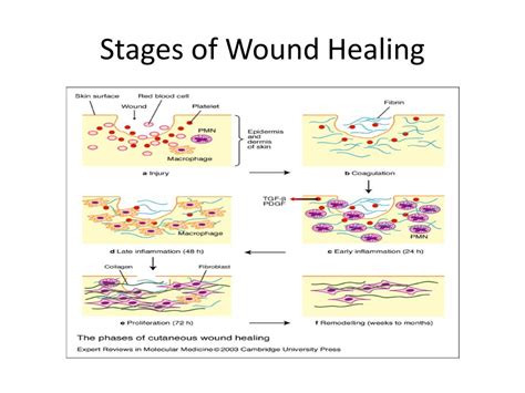 Photos Of Wound Healing Stages