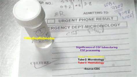 Cerebrospinal fluid (CSF) Culture and Sensitivity: Introduction