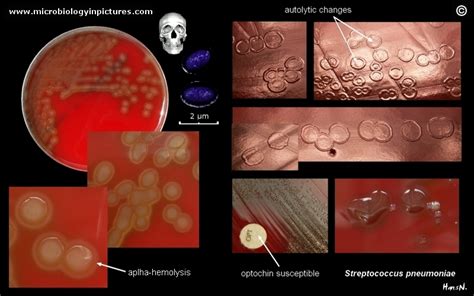 Streptococcus pneumoniae colony morphology and microscopic appearance ...