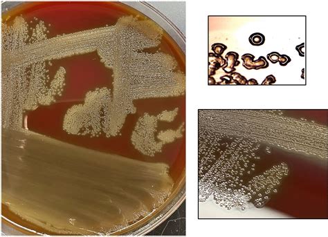 Streptococcus Pneumoniae Colony Morphology