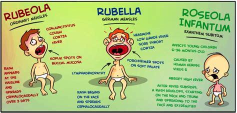 Doc Willie Ong - Sintomas ng Tigdas (Measles) at Tigdas Hangin | Facebook