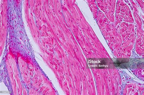 Anatomi Pendidikan Dan Sampel Histologis Jaringan Otot Jantung Di Bawah ...