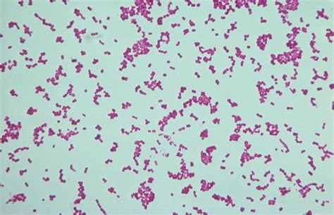 Neisseria Gonorrhoeae Gram Stain