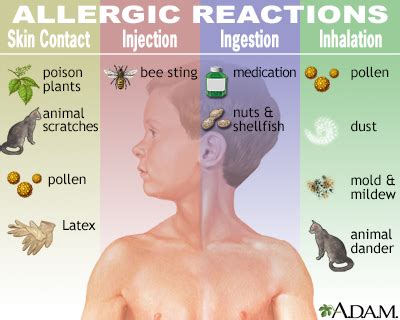 Allergic reactions