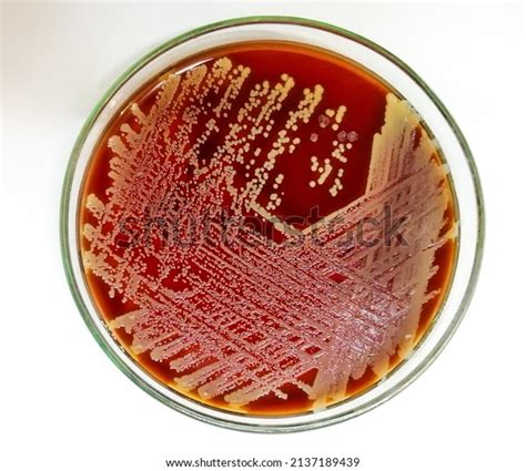 Staph Aureus Gram Positive Bacteria Staphylococcus Stock Photo ...