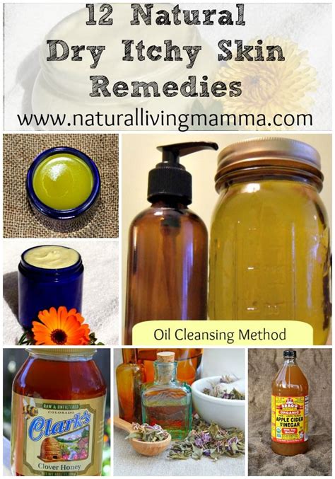 12 Natural Dry Itchy Skin Remedies - Natural Living Mamma | Dry itchy ...