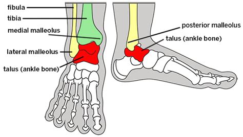 Broken Ankle: Types of Fractures, Diagnosis & Treatments | HSS