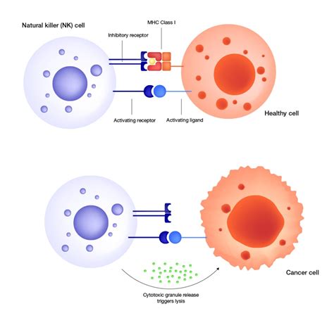 What is CAR-NK therapy, and is it the ‘off-the-shelf' solution the ...