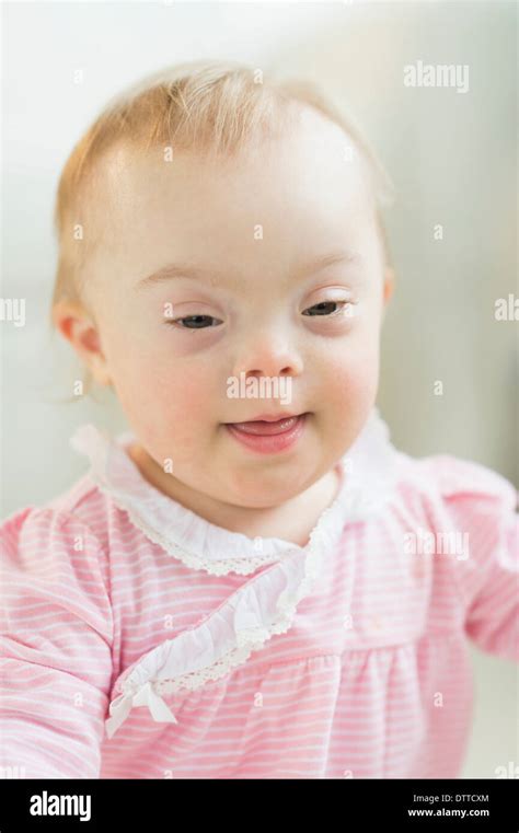 Baby girl down syndrome hi-res stock photography and images - Alamy