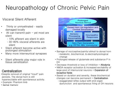 PPT - Chronic Pelvic Pain Pelvic Congestion Syndrome PowerPoint ...