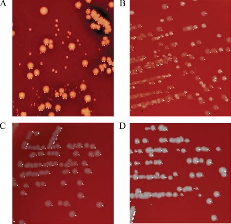 Staphylococcus Saprophyticus Colony Morphology