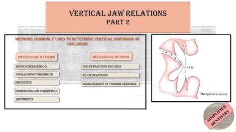 Vertical Jaw Relation | Vertical Dimension of Occlusion | Closest ...