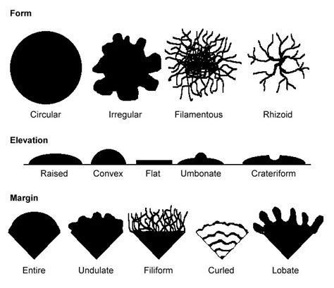 Colony Morphology of Bacteria • Microbe Online