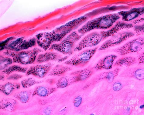 Skin Photograph by Jose Calvo/science Photo Library - Fine Art America