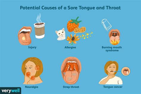 How To Help An Itchy Throat - Sellsense23