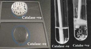 Catalase Test- Principle, Uses, Procedure, Result Interpretation with ...