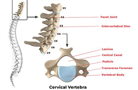 Cervical Spine Surgery Bridgewater MA | Cervical Spine Treatments ...