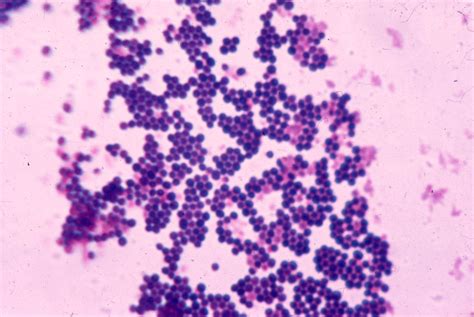 bsm15 - Gram-stained Staphylococcus aureus. approx. X 1000.jpg | Staph ...