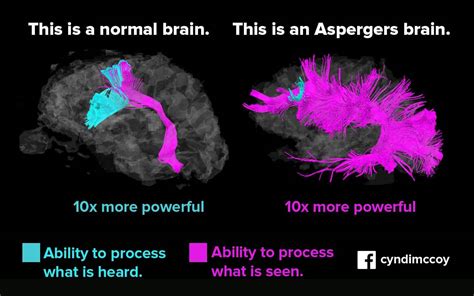 Asperger's Syndrome Explained, the Symptoms and Treatment