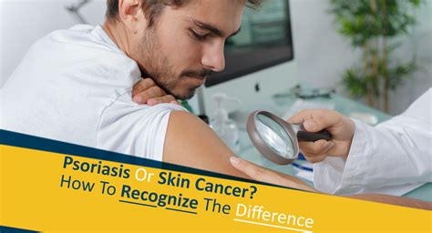 Psoriasis Or Skin Cancer? How To Recognize The Difference