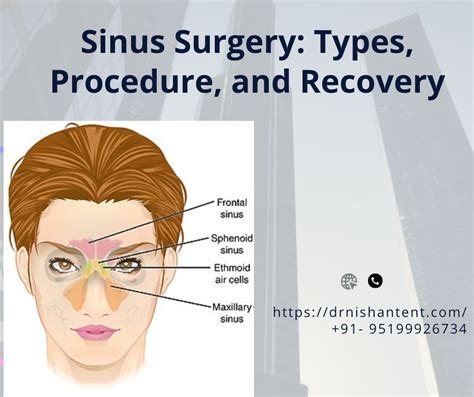 Sinus Surgery: Types, Procedure, and Recovery – Dr. Nishant ENT